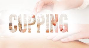 cupping acupuncture cary nc