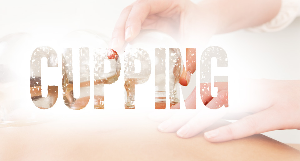 text quote cupping end quote over picture of practitioner applying cupping therapy